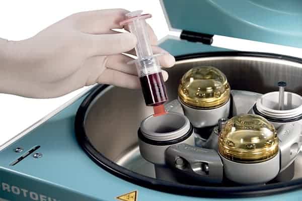 infiltrations prp injections traitement plasma riche plaquette articulations genou doigts epaule pieds rhumatologie interventionnelle paris vincennes dr jimmy gross infiltrations prp injections traitement plasma riche plaquette articulations genou doigts epaule pieds rhumatologie interventionnelle paris vincennes dr jimmy gross