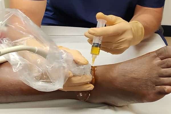 traitement infiltration corticoides rhumatologie interventionnelle docteur gross paris traitement infiltration corticoides rhumatologie interventionnelle docteur gross paris