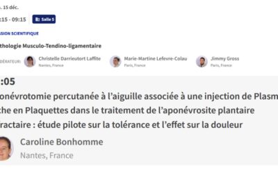 Etude aponévrosite et PRP au congrès de la Société Française de Rhumatologie